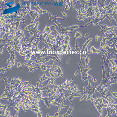 C4-2B人前列腺癌细胞（STR鉴定报告）