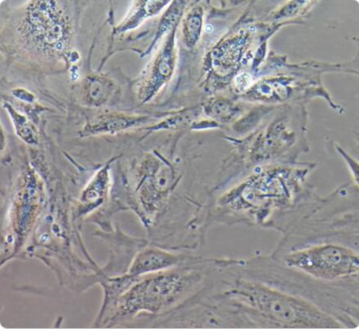 A7R5 大鼠胸大动脉平滑肌细胞