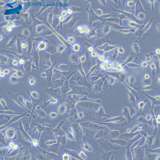 人转移胰腺腺癌细胞AsPC-1 （STR鉴定已通过）