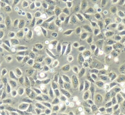 5637 人膀胱癌细胞