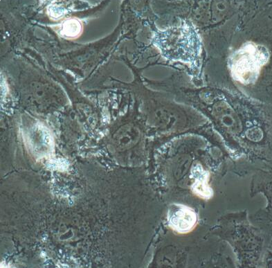 CHO-dhfr 中国仓鼠卵巢细胞（缺失二氢叶酸还原酶）