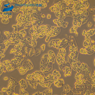 人肝癌细胞hepg2.2.15（STR鉴定已通过）