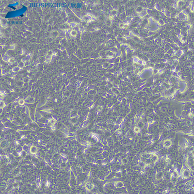 22RV1人前列腺癌细胞(提供STR鉴定报告)