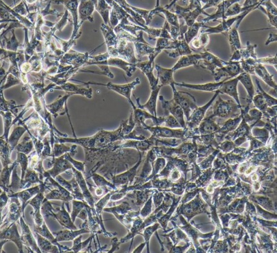 A172 人胶质母细胞瘤细胞