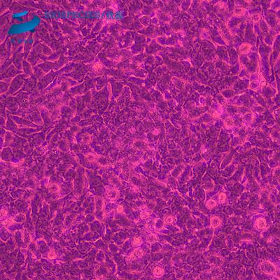 人肝癌细胞HEPG2 (STR鉴定已通过）