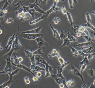 BT-549 人乳腺管癌细胞