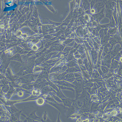 67NR小鼠乳腺癌细胞