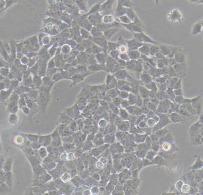 A673人横纹肌瘤细胞