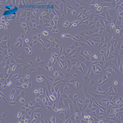 小鼠卵巢上皮癌细胞ID8