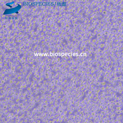 CoC1人卵巢癌细胞(提供STR鉴定报告)