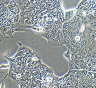 Capan-1 人胰腺癌细胞